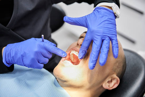Best Knocked-Out Tooth Emergency  in Minneola, FL